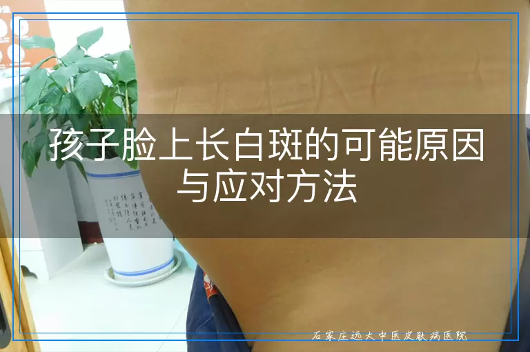 孩子脸上长白斑的可能原因与应对方法