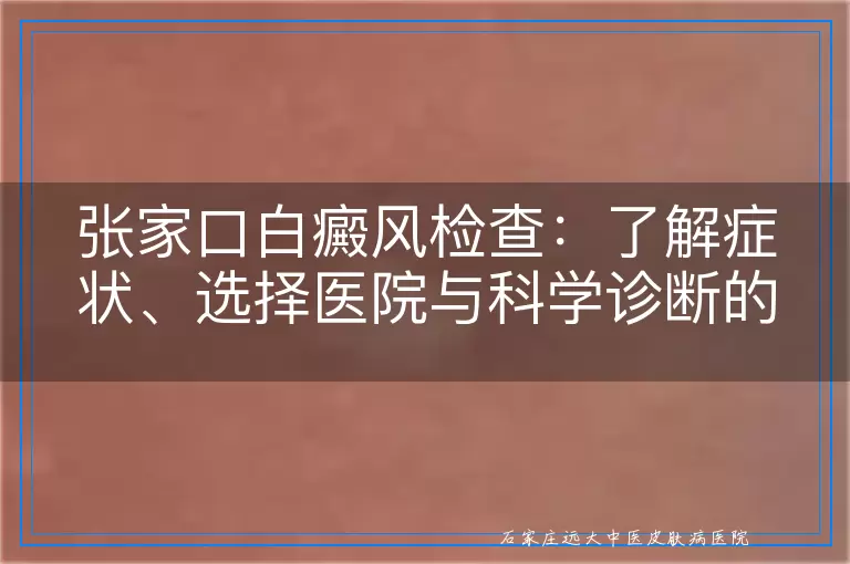 张家口白癜风检查：了解症状、选择医院与科学诊断的全面指南