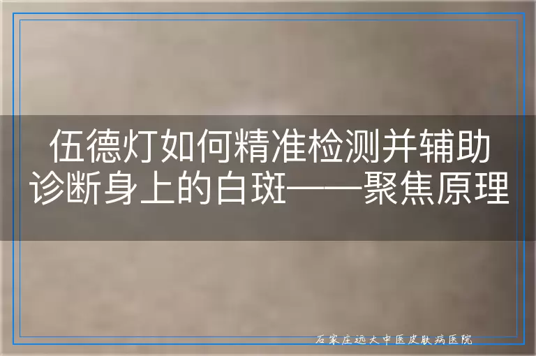 伍德灯如何精准检测并辅助诊断身上的白斑——聚焦原理、步骤与注意事项