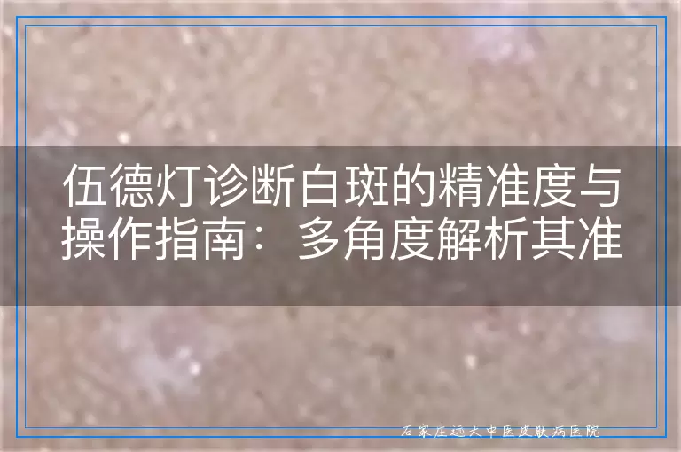 伍德灯诊断白斑的精准度与操作指南：多角度解析其准确率