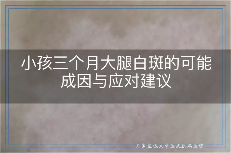 小孩三个月大腿白斑的可能成因与应对建议