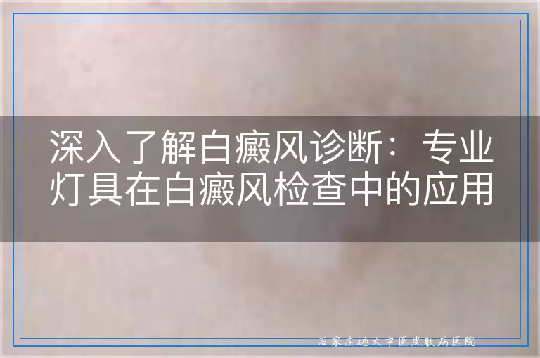 深入了解白癜风诊断：专业灯具在白癜风检查中的应用与重要性