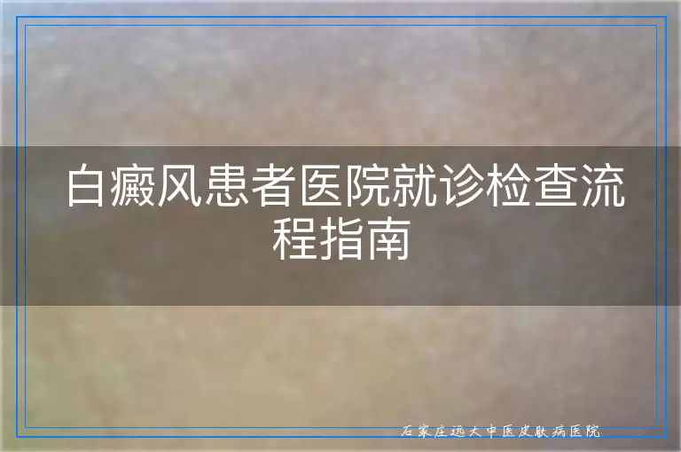 白癜风患者医院就诊检查流程指南