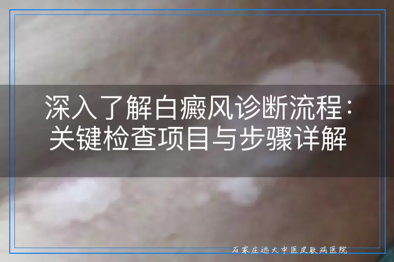 深入了解白癜风诊断流程：关键检查项目与步骤详解