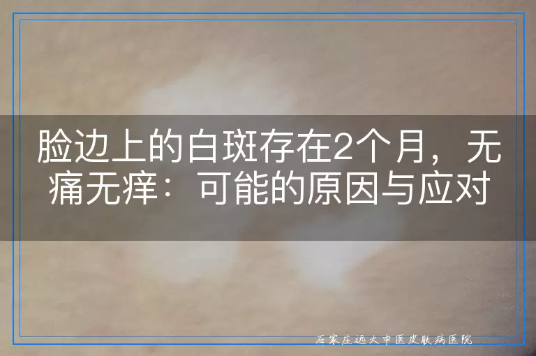 脸边上的白斑存在2个月，无痛无痒：可能的原因与应对思考