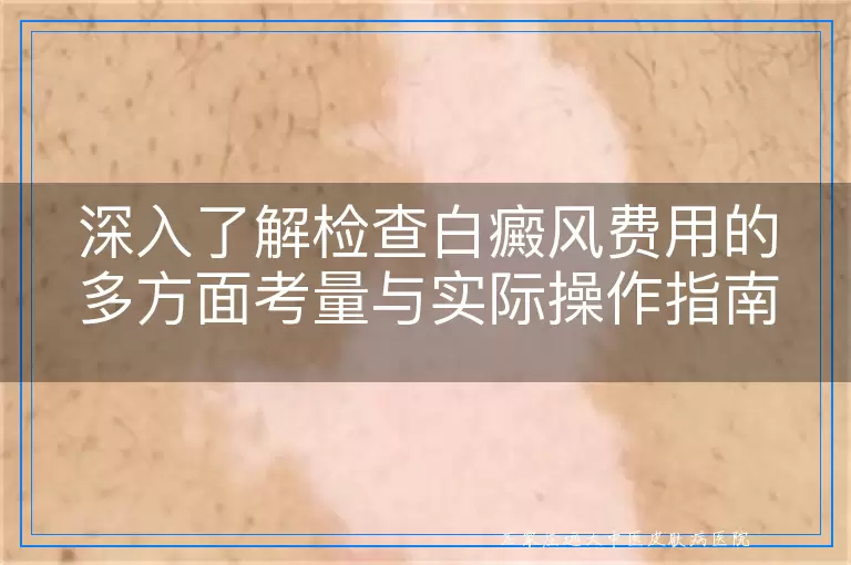 深入了解检查白癜风费用的多方面考量与实际操作指南