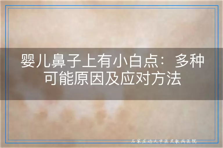 婴儿鼻子上有小白点：多种可能原因及应对方法