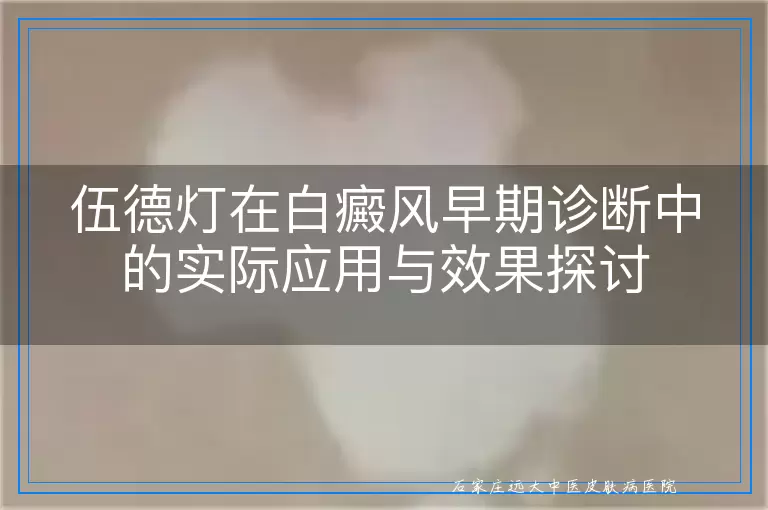 伍德灯在白癜风早期诊断中的实际应用与效果探讨