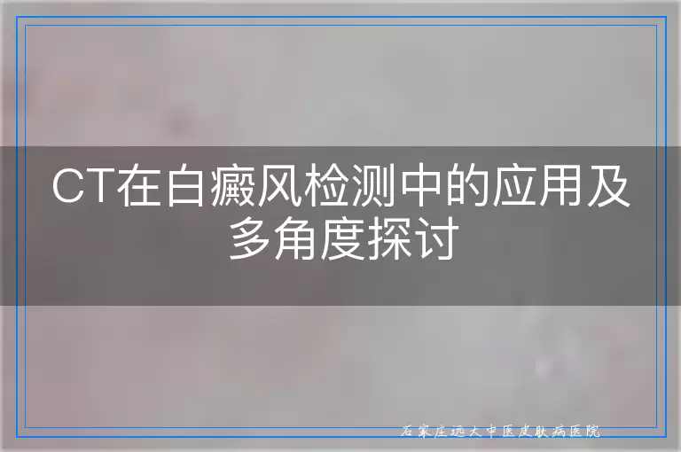 CT在白癜风检测中的应用及多角度探讨