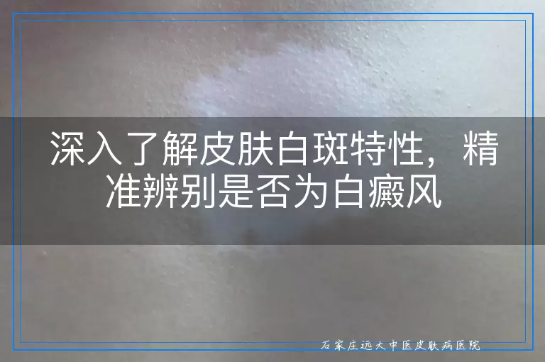 深入了解皮肤白斑特性，精准辨别是否为白癜风