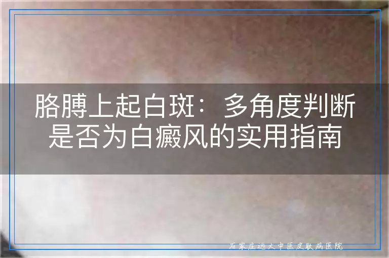 胳膊上起白斑：多角度判断是否为白癜风的实用指南