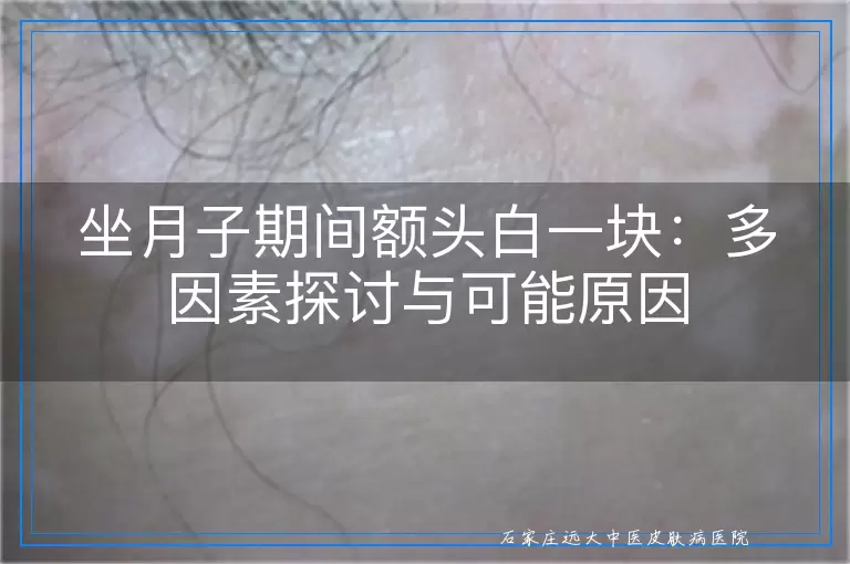 坐月子期间额头白一块：多因素探讨与可能原因