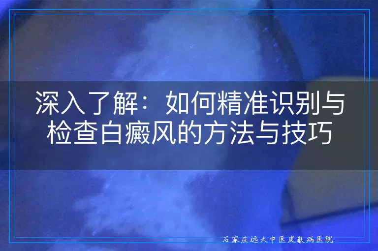 深入了解：如何精准识别与检查白癜风的方法与技巧