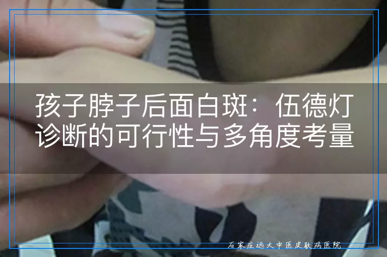 孩子脖子后面白斑：伍德灯诊断的可行性与多角度考量