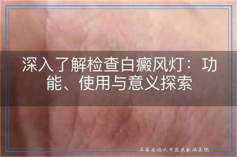 深入了解检查白癜风灯：功能、使用与意义探索