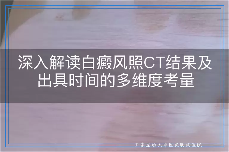 深入解读白癜风照CT结果及出具时间的多维度考量