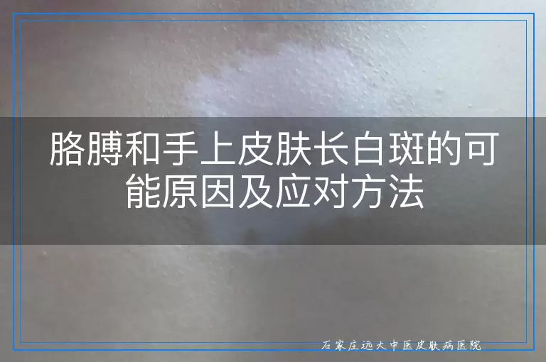 胳膊和手上皮肤长白斑的可能原因及应对方法