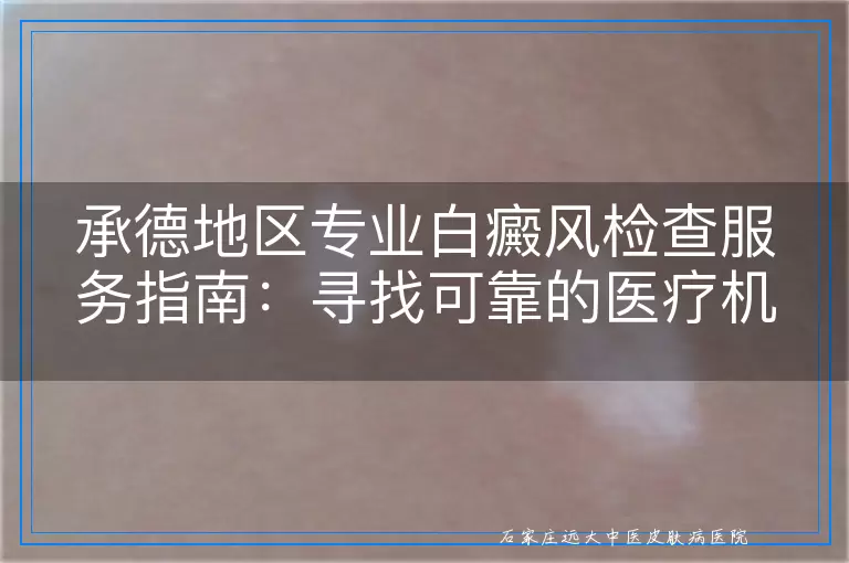 承德地区专业白癜风检查服务指南：寻找可靠的医疗机构