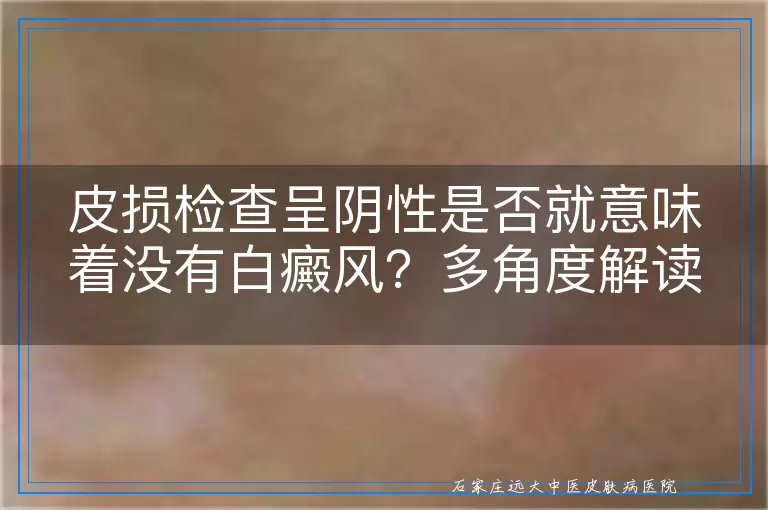 皮损检查呈阴性是否就意味着没有白癜风？多角度解读与探讨