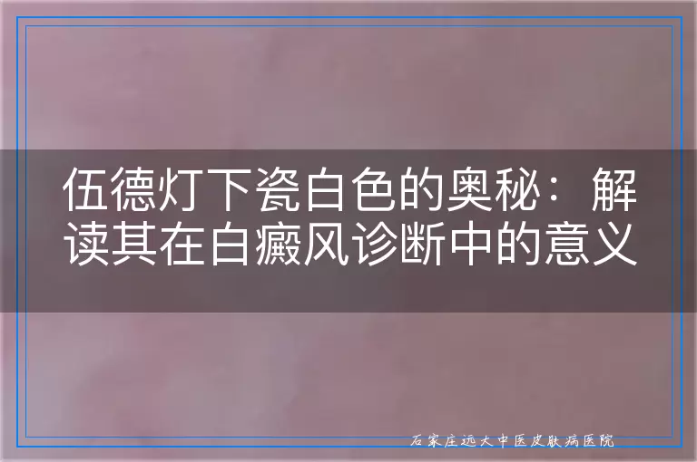 伍德灯下瓷白色的奥秘：解读其在白癜风诊断中的意义