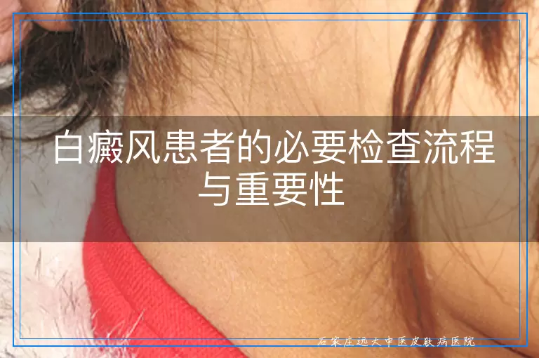白癜风患者的必要检查流程与重要性