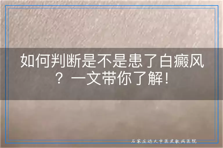 如何判断是不是患了白癜风？一文带你了解！