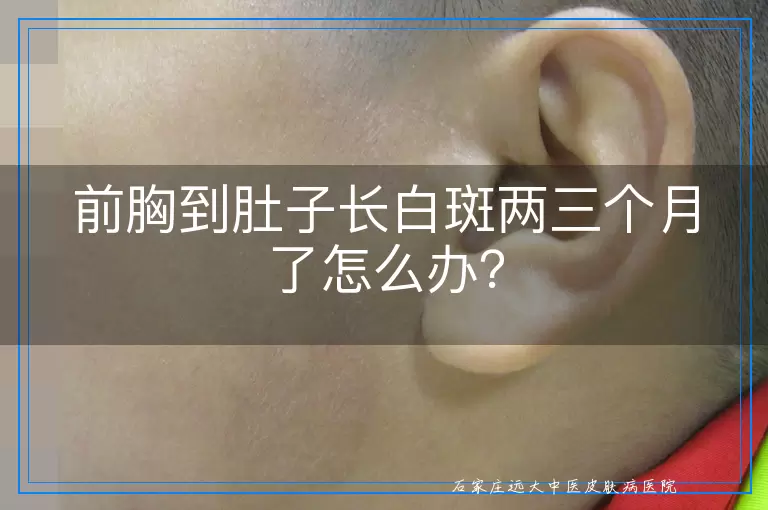 前胸到肚子长白斑两三个月了怎么办？