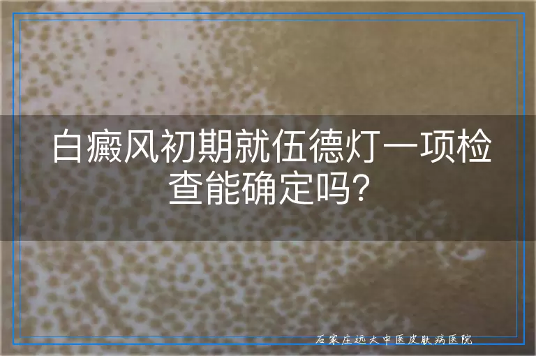 白癜风初期就伍德灯一项检查能确定吗？