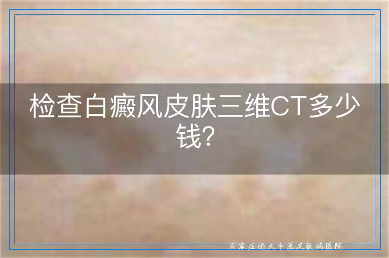 检查白癜风皮肤三维CT多少钱？