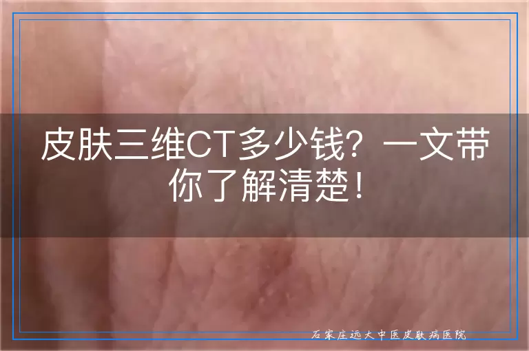 皮肤三维CT多少钱？一文带你了解清楚！