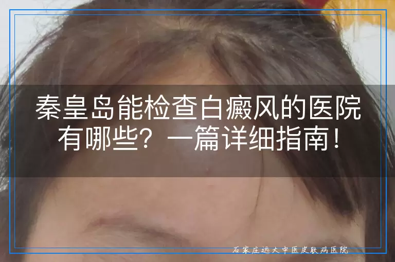 秦皇岛能检查白癜风的医院有哪些？一篇详细指南！