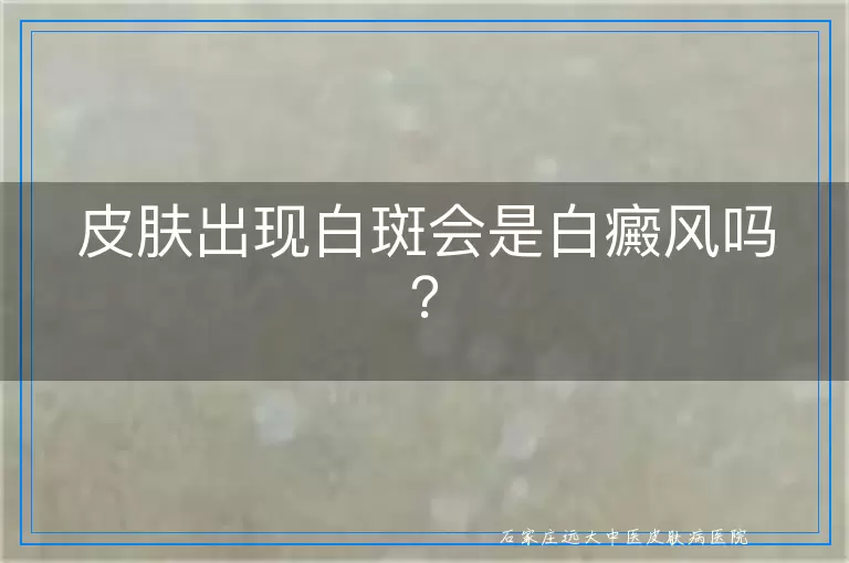 皮肤出现白斑会是白癜风吗？