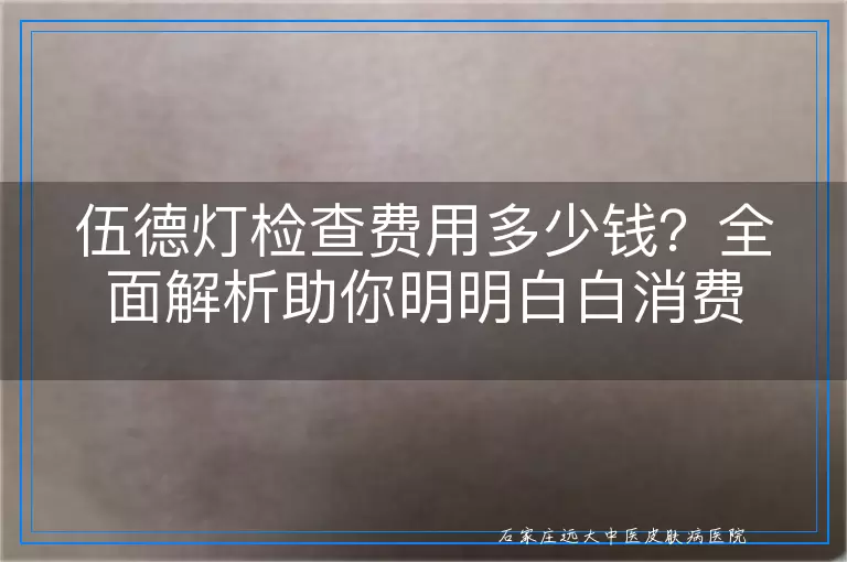 伍德灯检查费用多少钱？全面解析助你明明白白消费