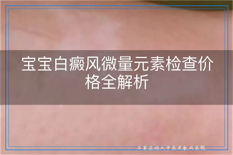 宝宝白癜风微量元素检查价格全解析