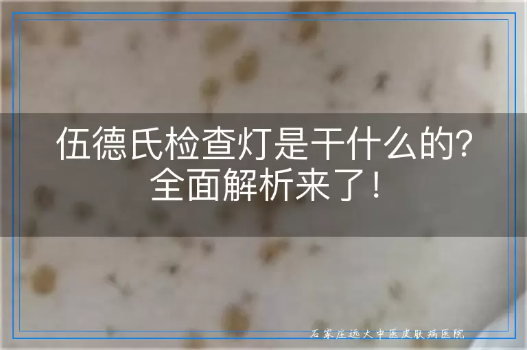 伍德氏检查灯是干什么的？全面解析来了！