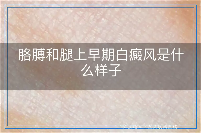 胳膊和腿上早期白癜风是什么样子