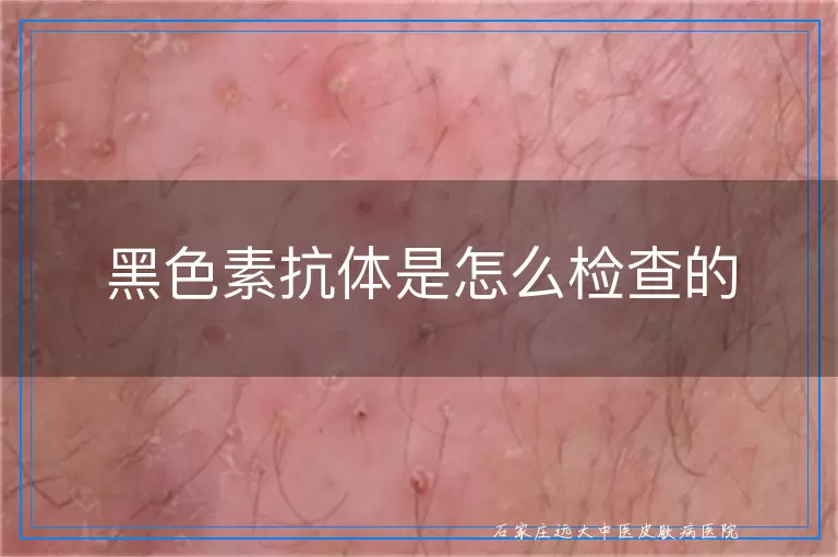 黑色素抗体是怎么检查的