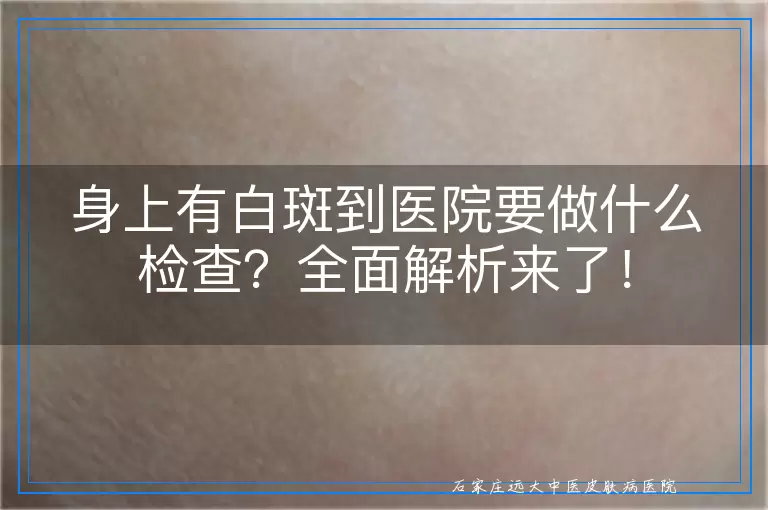 身上有白斑到医院要做什么检查？全面解析来了！