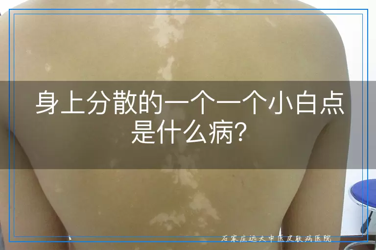 身上分散的一个一个小白点是什么病？