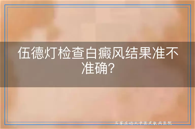伍德灯检查白癜风结果准不准确？