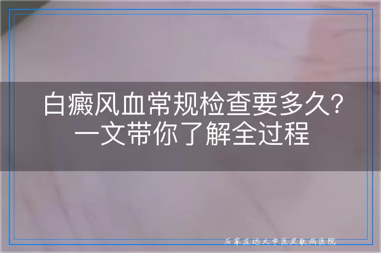 白癜风血常规检查要多久？一文带你了解全过程