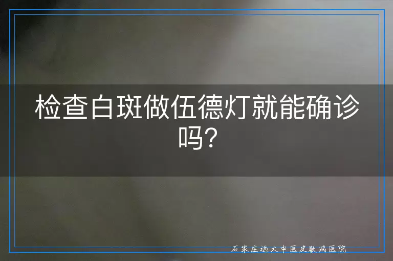 检查白斑做伍德灯就能确诊吗？