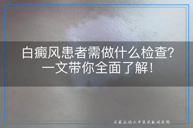 白癜风患者需做什么检查？一文带你全面了解！