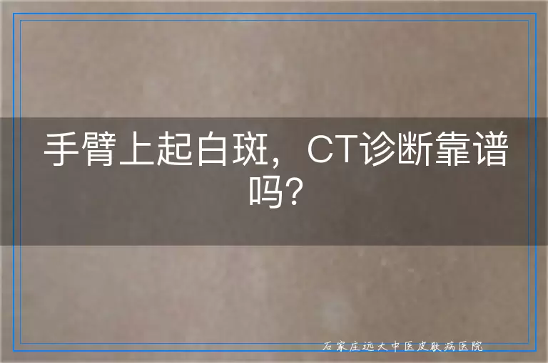 手臂上起白斑，CT诊断靠谱吗？