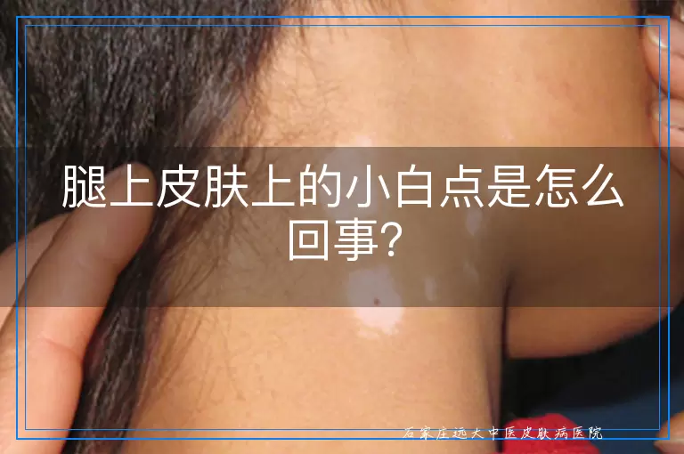 腿上皮肤上的小白点是怎么回事？