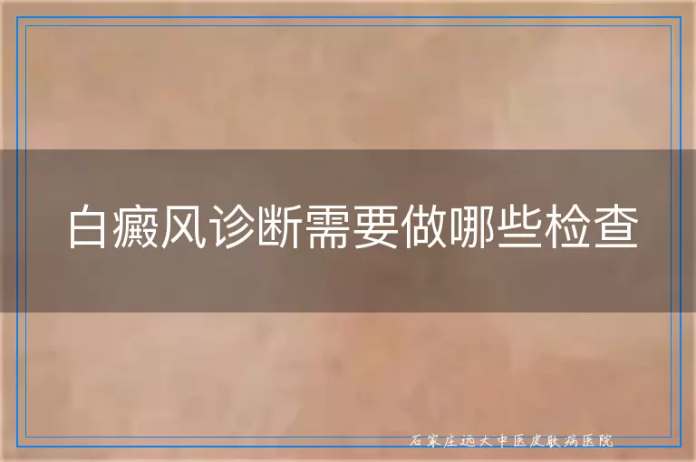 白癜风诊断需要做哪些检查