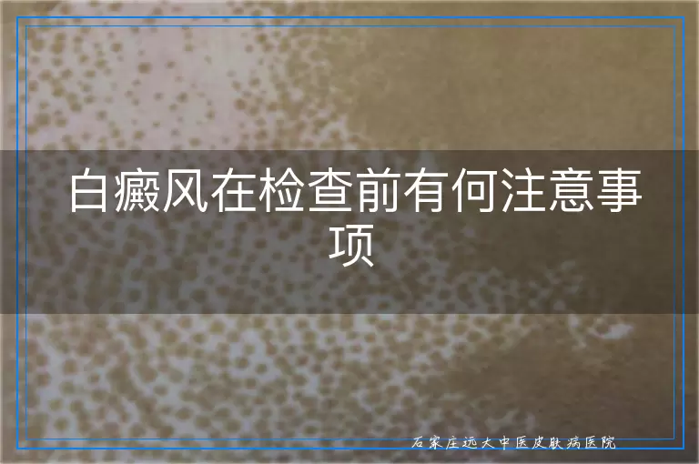 白癜风在检查前有何注意事项