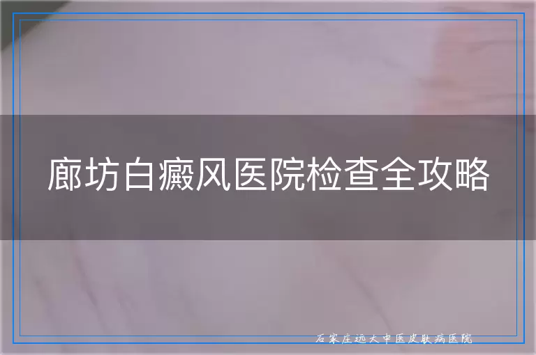 廊坊白癜风医院检查全攻略