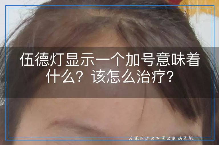 伍德灯显示一个加号意味着什么？该怎么治疗？