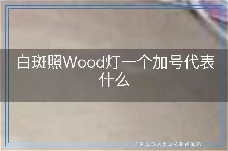 白斑照Wood灯一个加号代表什么